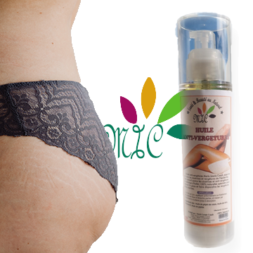 HUILE ANTI-VERGETURES